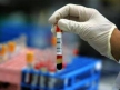 В США одобрен первый генетический тест для определения совместимости крови