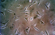 Мезенхимальные стволовые клетки иммунологически безопасны