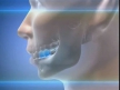 Ученые разработали гель, позволяющий стимулировать рост искусственных зубов
