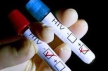 Более 200 человек в России ежедневно заражаются ВИЧ 