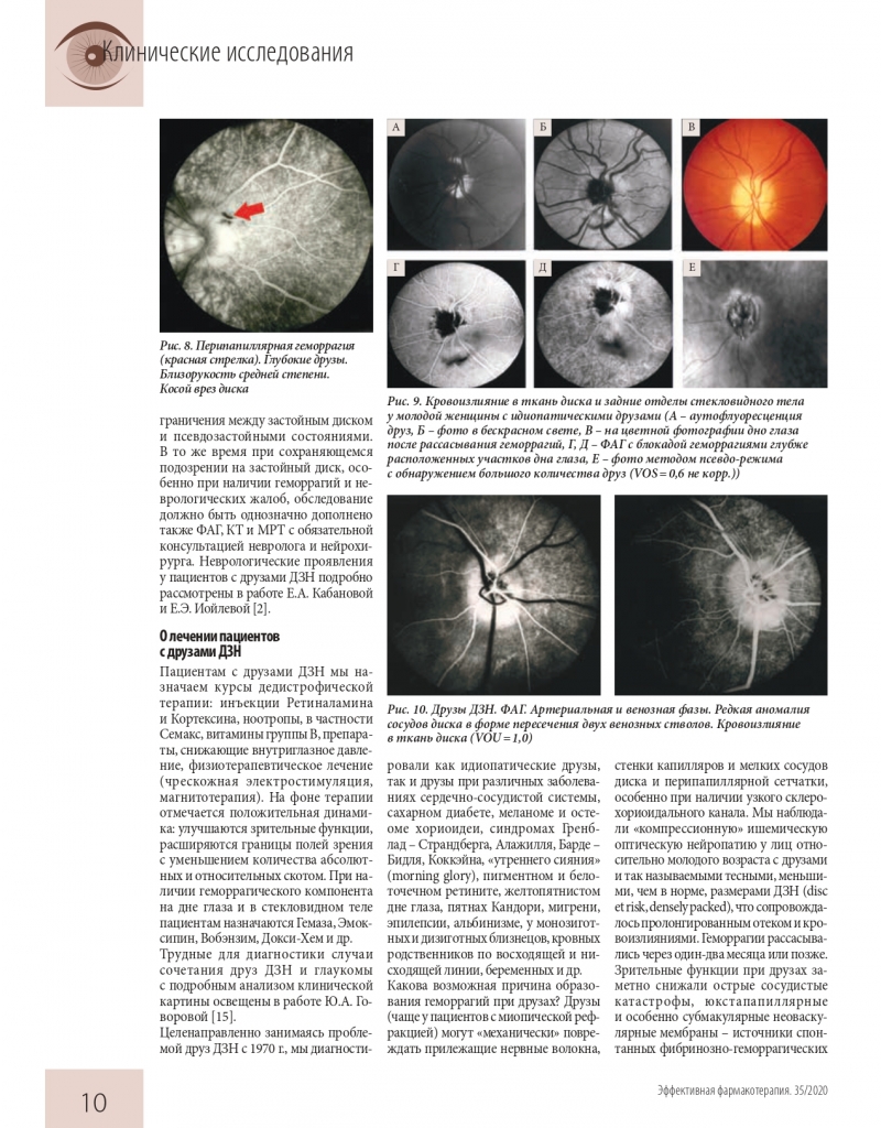 effektivnaya_farmakoterapiya_oftalmologiya_2_2020_pages-to-jpg-0012.jpg