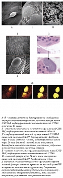 Рис. 2. Внутриклеточные бактериальные сообщества. Инфицированные мочевые пузыри были разрезаны, фиксированы и исследованы с помощью сканирующей электронной микроскопии или световой микроскопии (окраска гематоксилином и эозином)