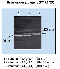 Рисунок 4. Генотипирование динуклеотидного полиморфизма гена UGT1A1 при помощи гель-электрофореза