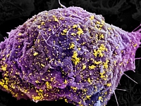 Клетка, покрытая частицами ВИЧ (фото Dr. Thomas Deerinck)