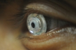 Ученые разработали телескопическую контактную линзу