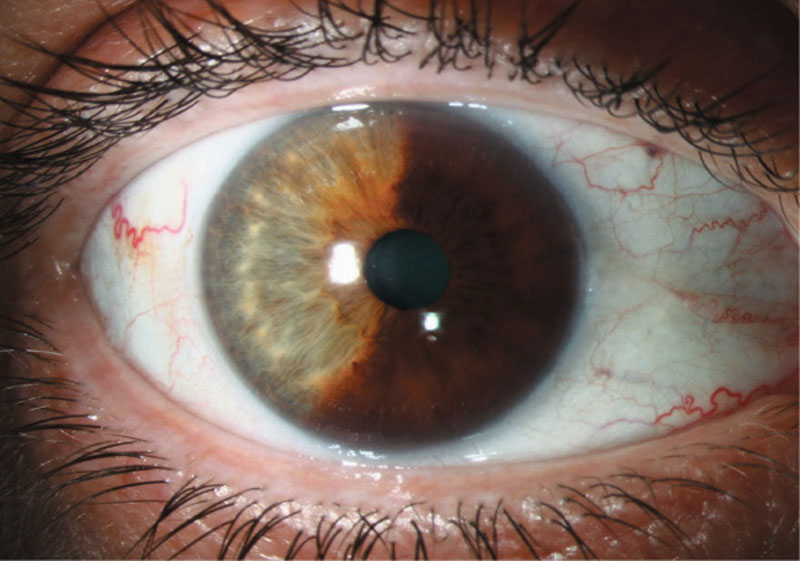 Доклад: Компьютерная термография в диагностике злокачественных опухолей глаза и орбиты