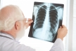 Пульмонолог рассказал о рисках развития бронхиальной астмы после коронавируса