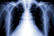 Туберкулёз использует для заражения иммунные клетки лёгких