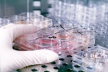 Новосибирские ученые научились выявлять рак через нанодиагностику мочи