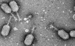 Израильские ученые открыли «атакующий» бактерии белок