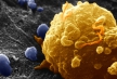 Комбинация лекарств оказалась смертельной для клеток ряда злокачественных опухолей
