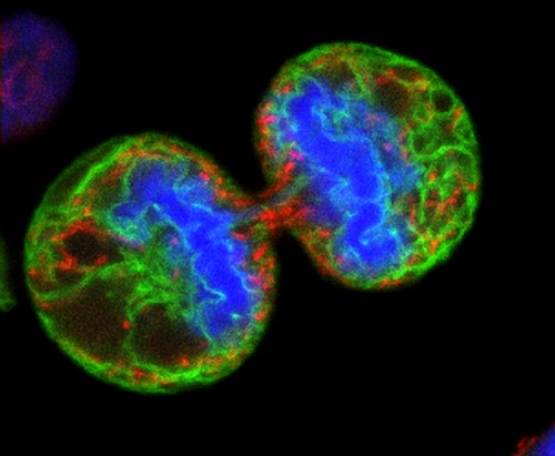 Делящиеся клетки меланомы человека (фото wellcome images).