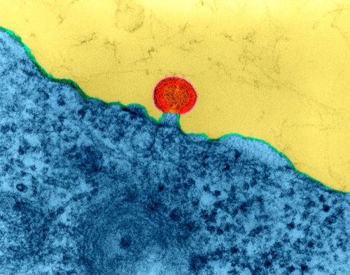 ВИЧ покидает клетку (Фото Dennis Kunkel Microscopy, Inc.)