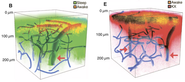 Изменение объема межклеточного пространства в мозге мыши при пробуждении (слева) и при введении анестетиков (справа).