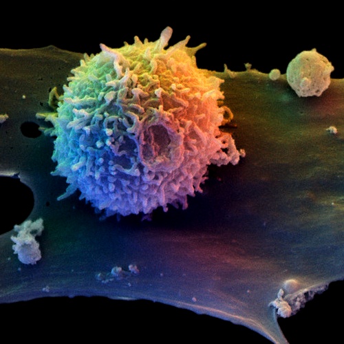 Т-клетка, расположившаяся на другой иммунной клетке, дендритной (фото David Scharf).