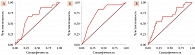 Рис. 3. RОC-кривые, отображающие взаимосвязь между вероятностью летального исхода и возрастом (А), индексом массы тела (Б), индексом коморбидности Чарлсона (В)