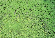 Рис. 9. Бесклеточная гомогенная некротическая масса в очаге ишемии (окрашивание гематоксилином и эозином, увеличение 10 × 40)