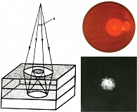 Рис. 3. Схема образования зоны кольцевидного непрямого освещения ДЗН  при офтальмохромоскопии в непрямом красном свете с использованием  по пути светового потока непрозрачного диска. В непрямом красном свете диагностированы друзы