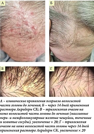 Рис. 3. Пациент Т., 58 лет: