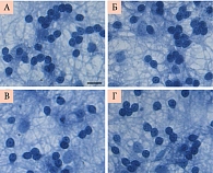Рис. 6. Культивированные зернистые нейроны мозжечка крыс при действии глутамата и миоинозитола: А – контроль; Б – миоинозитол 0,5 мМ; В – глутамат 100 мкМ; Г – миоинозитол и глутамат. Фиксированные культуры, окрашенные трипановым синим. Масштаб – 15 мкм