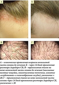 Рис. 2. Пациент К., 21 год:
