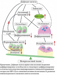 Рис. 2. Потенциальный механизм влияния железодефицита на развитие остеопороза (адаптировано из [10])