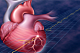 Профилактика инфаркта миокарда и инсульта: единый подход