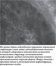 Рис. 6. Конфокальная микроскопия in vivo: