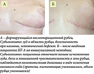 Рис. 2. Пациентка И., 46 лет