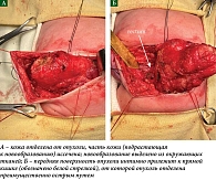 Рис. 3. Первый этап операции: