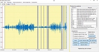 Рис. 1. Графический интерфейс программы «Акустический анализ храпа v. 6.0» с результатами обработки аудиозаписи храпа пациента Р. в течение одной ночи