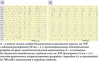 Рис. 4. ЭЭГ пациентки в состоянии оглушения