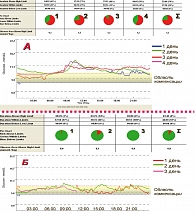 Рисунок 3. Динамика суточного мониторирования  гликемического  профиля до (А) и после (Б) лечения (6 месяцев) у больного М. 56 лет