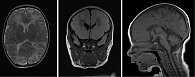 Магнитно-резонансная томография головного мозга от 10 октября 2023 г.