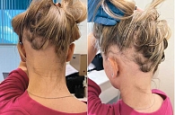 Рис. 1. Макросъемка очагов до начала курса терапии