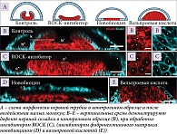 Рис. 1. Использование низкомолекулярных ингибиторов: