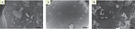 Рис. 10. Характерный вид частиц осадков после экспериментов по определению времени распадаемости (Де-Нол (А), Улькавис (Б), Эскейп (В), масштабный отрезок 1 мкм)