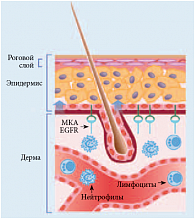 Рис. 1. Патогенез кожной токсичности при использовании анти-EGFR МКА
