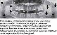 Рис. 1. Сиалограмма правой и левой околоушных слюнных желез пациентки О. 38 лет, суммарная введенная активность I-131 – 9,1 ГБк