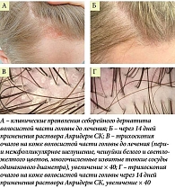 Рис. 2. Больной С., 37 лет: