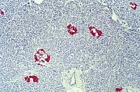 Островки Лангерганса — скопления бета-клеток поджелудочной железы, вырабатывающих инсулин (фото Visuals Unlimited / Corbis)