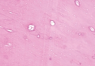 Рис. 5. Компактная костная ткань окрашена красным цветом (гистологический материал № 2919, увеличение × 100, окраска гематоксилином и эозином после предварительной декальцинации)