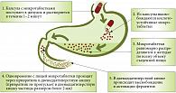 Рис. Схема перемещения препарата Эрмиталь (капсулы с микротаблетками) в желудочно-кишечном тракте