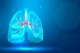 7% населения России страдает от бронхиальной астмы 