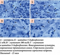 Рис. 10. Культивированные зернистые нейроны мозжечка крыс при действии глутамата и цитидин-5-дифосфохолина