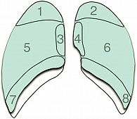 Рис. 2. Схема зон легких: 1 и 2 – апикальные зоны;  3 и 4 – медиастинальные зоны; 5 и 6 – латеральные зоны; 7 и 8 – наддиафрагмальные зоны
