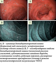 Рис. 2. Эндофото двенадцатиперстной кишки: