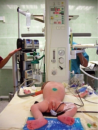 Рис. 4. Операционный стол для новорожденного – открытое рабочее место анестезиолога-реаниматолога