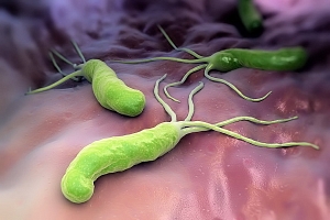 Спорные вопросы эрадикации Helicobacter pylori у пациентов, принимающих прямые оральные антикоагулянты