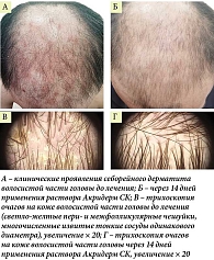 Рис. 4. Больной Т., 44 года: